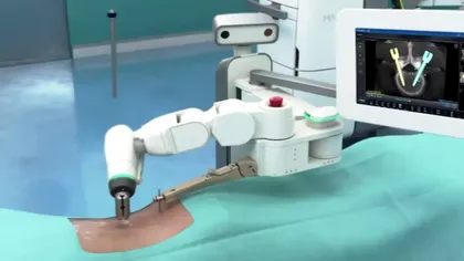 China testează un robot neurochirurg capabil să opereze complet autonom, fără intervenție umană