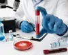 Un nou test de sânge promite să detecteze 50 de tipuri de cancer înainte de simptome