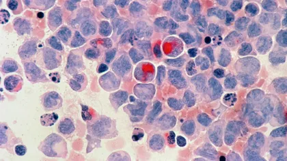 A apărut un nou colos medical în lupta împotriva cancerului