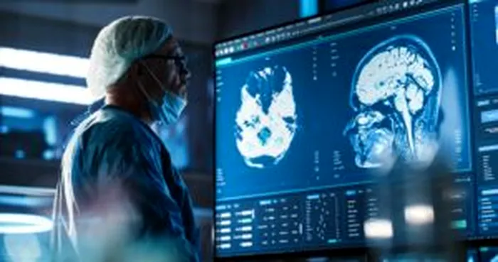 Brain FOTO Shutterstock