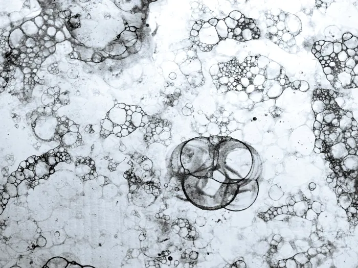 Foto: Unsplash