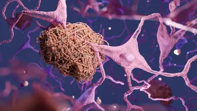 Noua descoperire a oamenilor de știință de la Harvard arată că litiul ar putea proteja creierul de Alzheimer