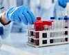 Testul secret de sânge de 800 de dolari care îți spune când și cât de repede îmbătrânești cu adevărat