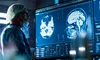 Un experiment-șoc în neuroștiință schimbă tot ce știam despre imagistica cerebrală. Tehnologia care spune totul despre activitatea neuronală