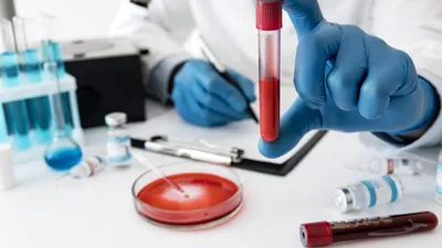 Un nou test de sânge promite să detecteze 50 de tipuri de cancer înainte de simptome