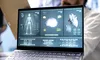 Cum transformă inteligenţa artificială startup-urile medicale în mașinării de profit și eficiență