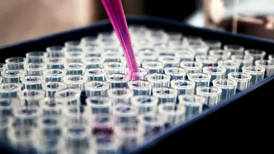 Miliardarii investesc masiv pentru a extinde viața dincolo de 100 de ani