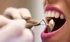 Țările unde oamenii merg cel mai des la dentist. România, la coada clasamentului