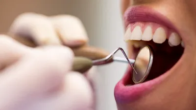 Țările unde oamenii merg cel mai des la dentist. România, la coada clasamentului