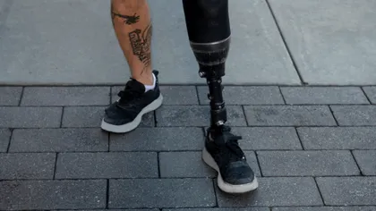 Cinism de la Kremlin: Nepoata lui Putin se laudă că Rusia a devenit lider mondial în protezarea membrelor datorită războiului din Ucraina