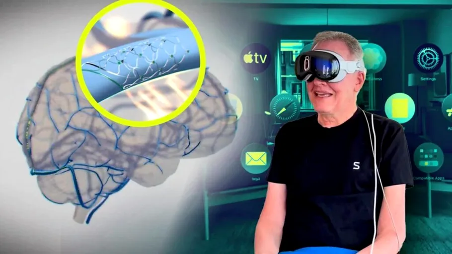 Apple pariază pe interfețele neurale. Cum vei putea controla dispozitivele direct prin gânduri