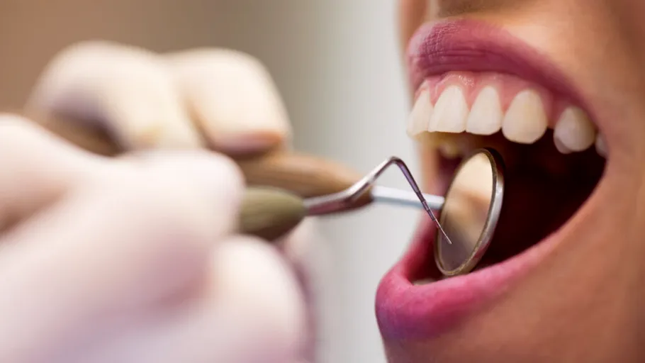 Țările unde oamenii merg cel mai des la dentist. România, la coada clasamentului
