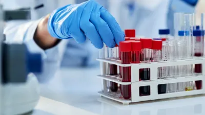 Testul secret de sânge de 800 de dolari care îți spune când și cât de repede îmbătrânești cu adevărat