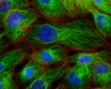 Se opune industria pharma accesibilizării tratamentelor pentru cancer?